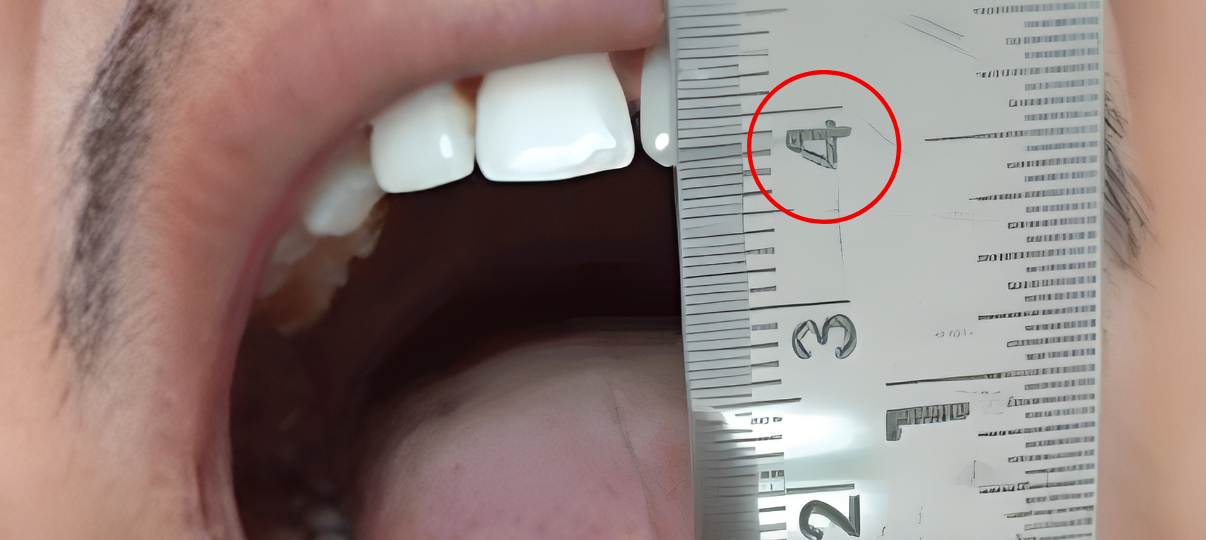 After Treatment