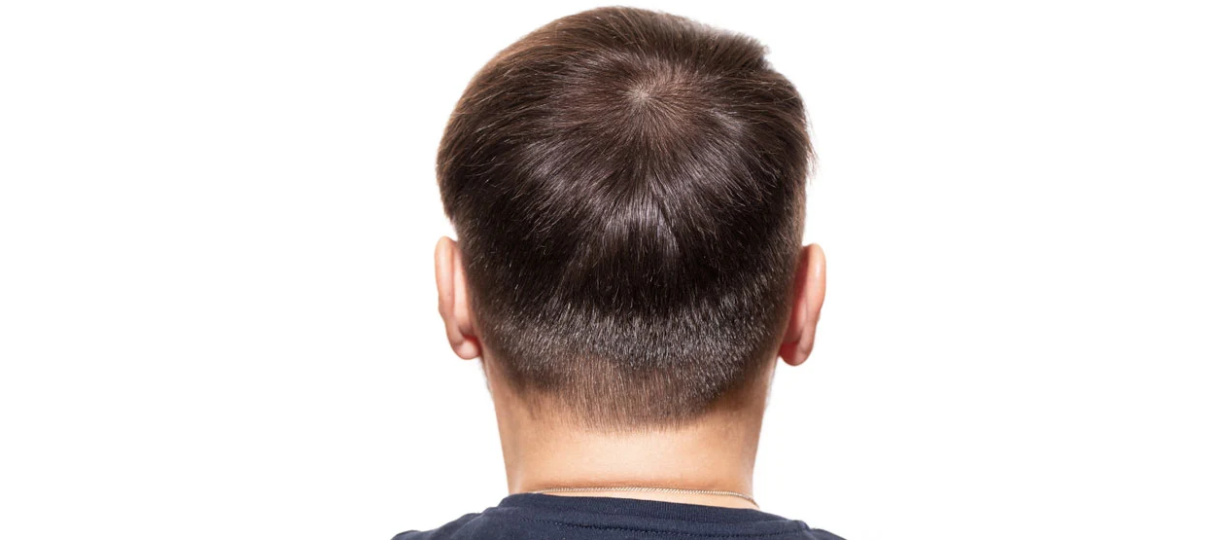 After Treatment
