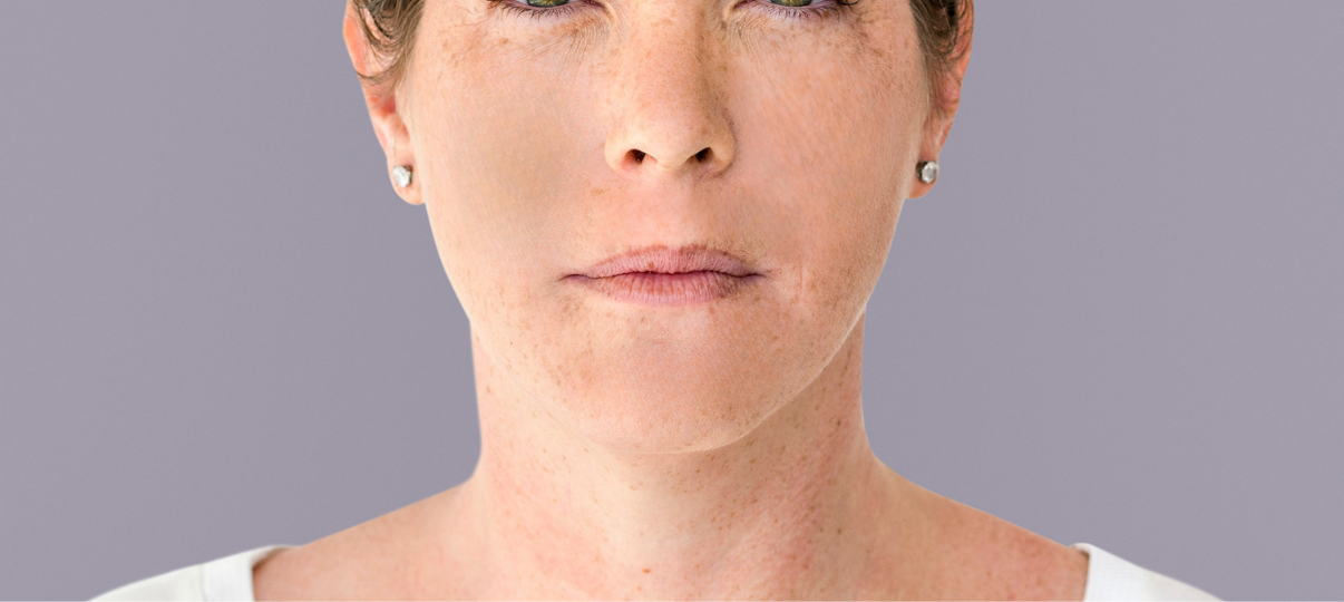 After Treatment