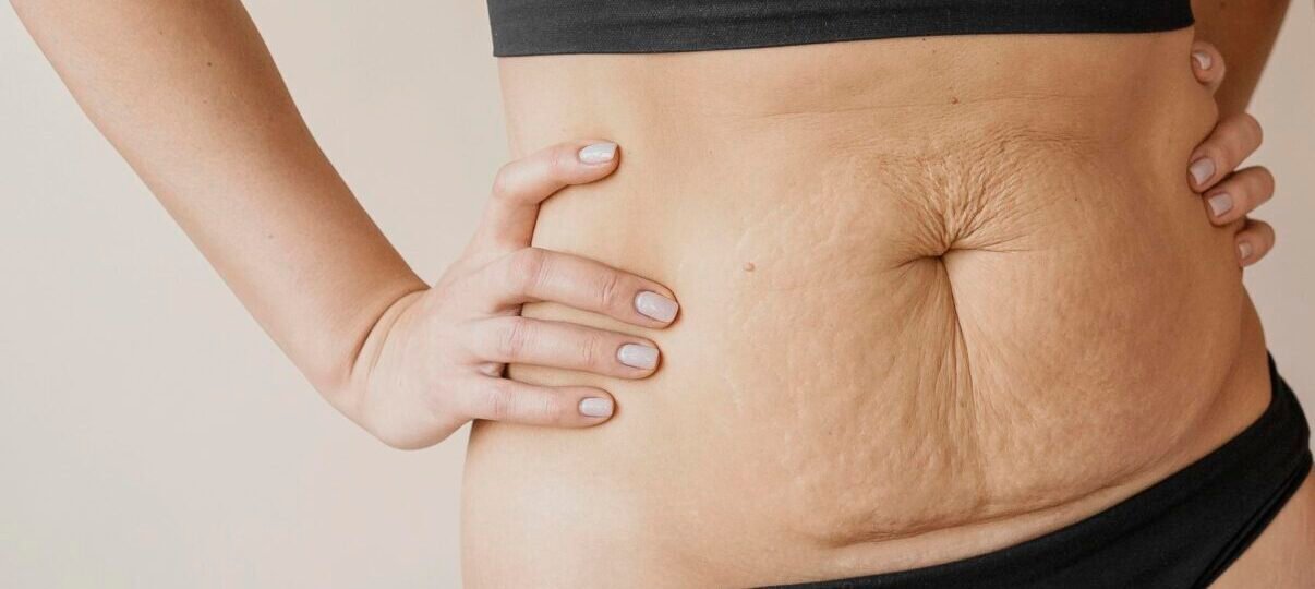 Before Treatment